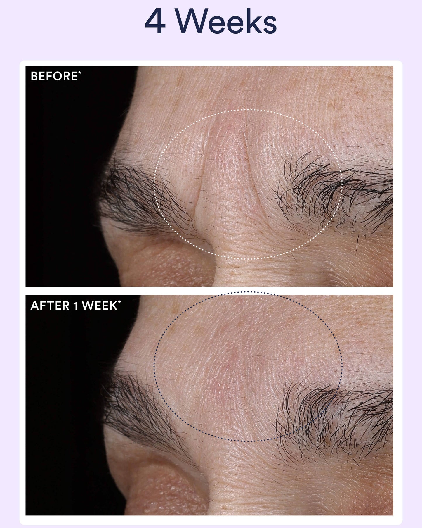 OSEA Dream Night Serum with Bio-Retinol clinical results or before and after visual for OSEA clean beauty shoppers at My Wrinkles Gone