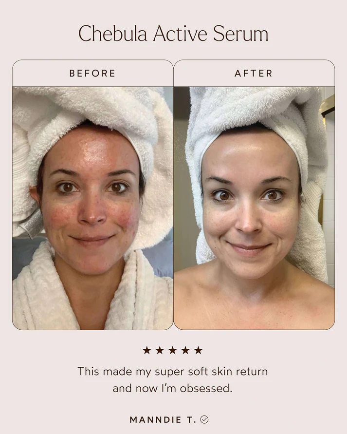 True Botanicals Chebula Active Serum clinical skincare results showing more even looking skin tone and radiant glowing skin after 4 weeks