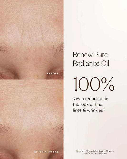 True Botanicals Renew Pure Radiance Oil before and after skincare results showing reduced appearance of fine lines and smoother looking skin after 4 weeks