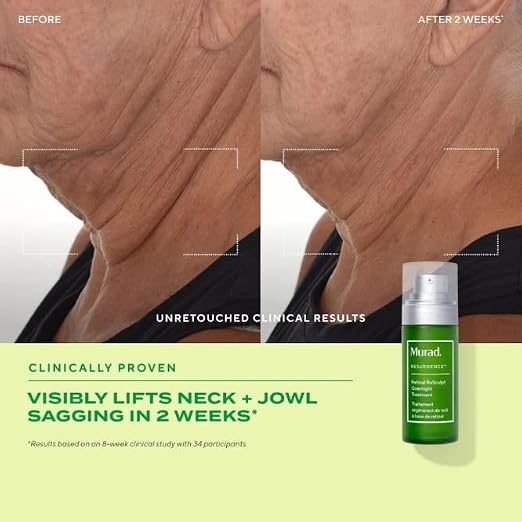Murad Retinal ReSculpt Overnight Treatment - box and bottle close-up - Murad overnight retinal face and neck treatment