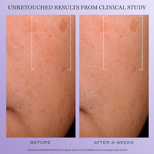 Lancôme Rénergie H.C.F. Triple Serum – Hyaluronic Acid, Vitamin C & Niacinamide additional product image 4 for details and texture