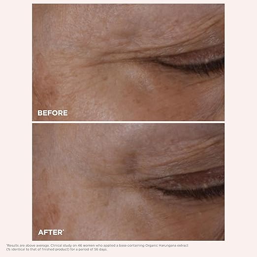 CLARINS Total Eye Lift skincare benefits graphic for eye care and smoother-looking eyes