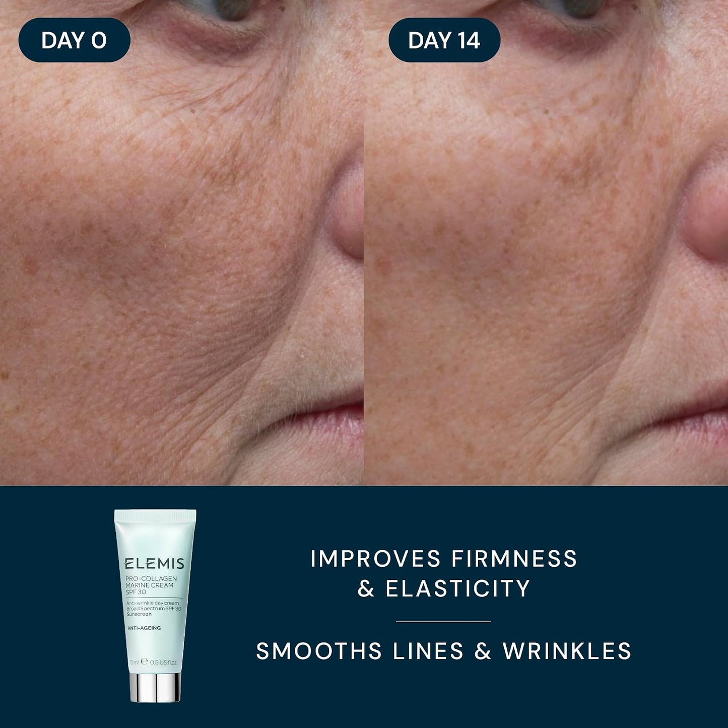 ELEMIS Healthy Skin Travel Set – Pro-Collagen Skincare Essentials