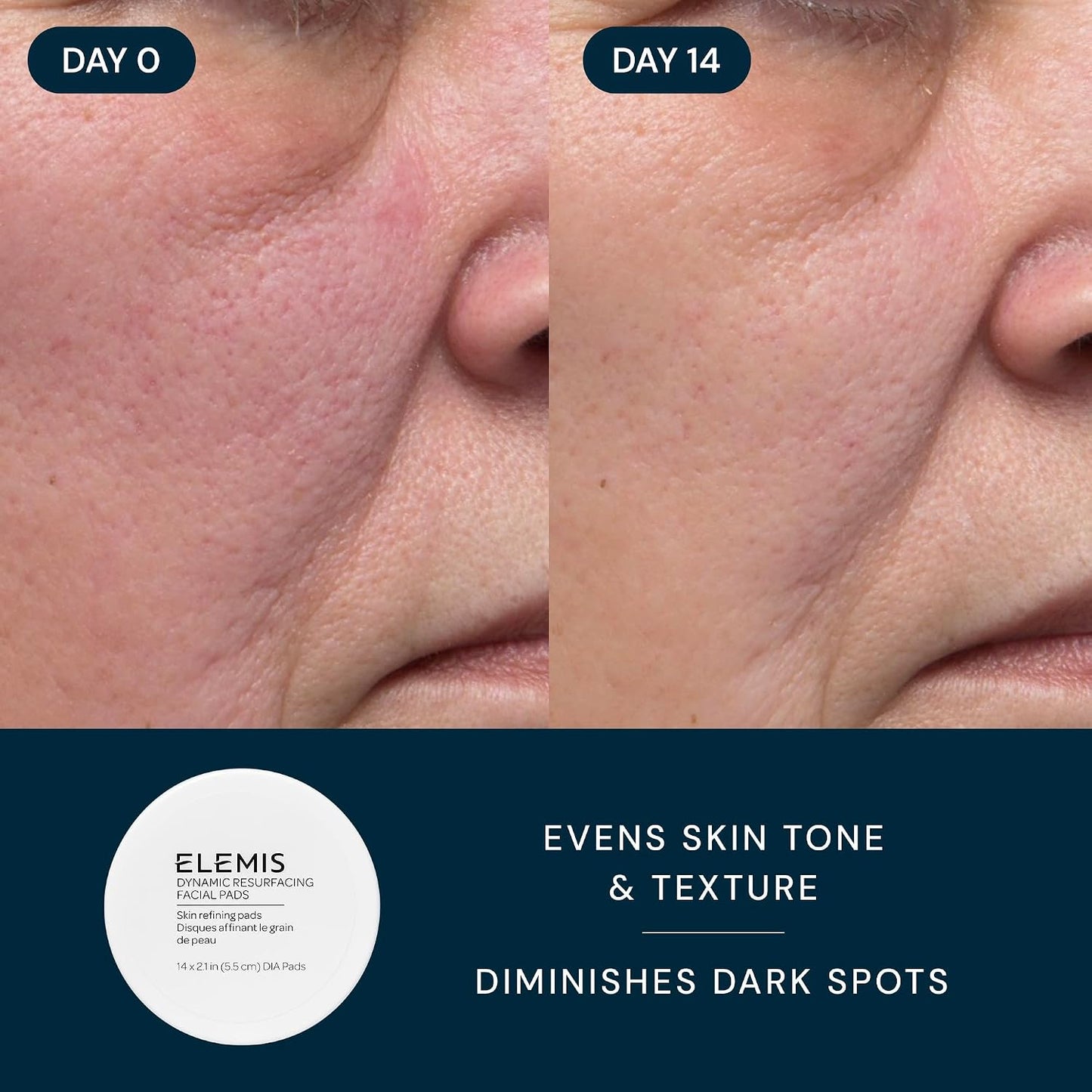 ELEMIS Healthy Skin Travel Set – Pro-Collagen Skincare Essentials