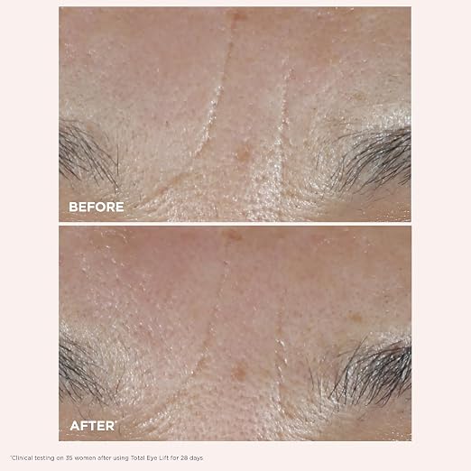 CLARINS Total Eye Lift texture or application detail for eye care and smoother-looking eyes