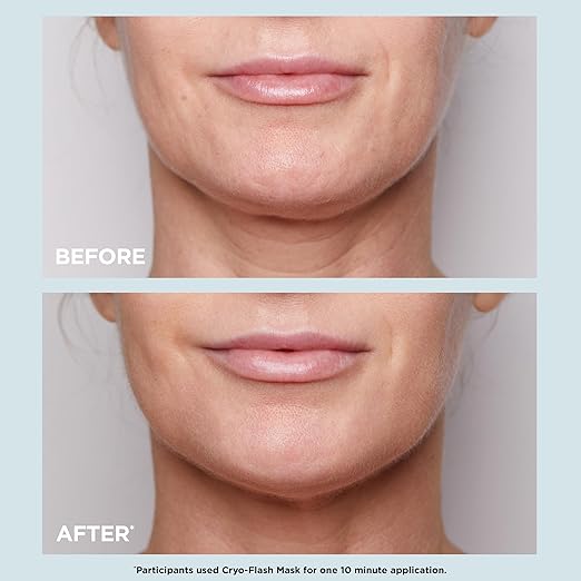 CLARINS Cryo-Flash Face Mask texture or application detail for radiance and lifted-looking skin