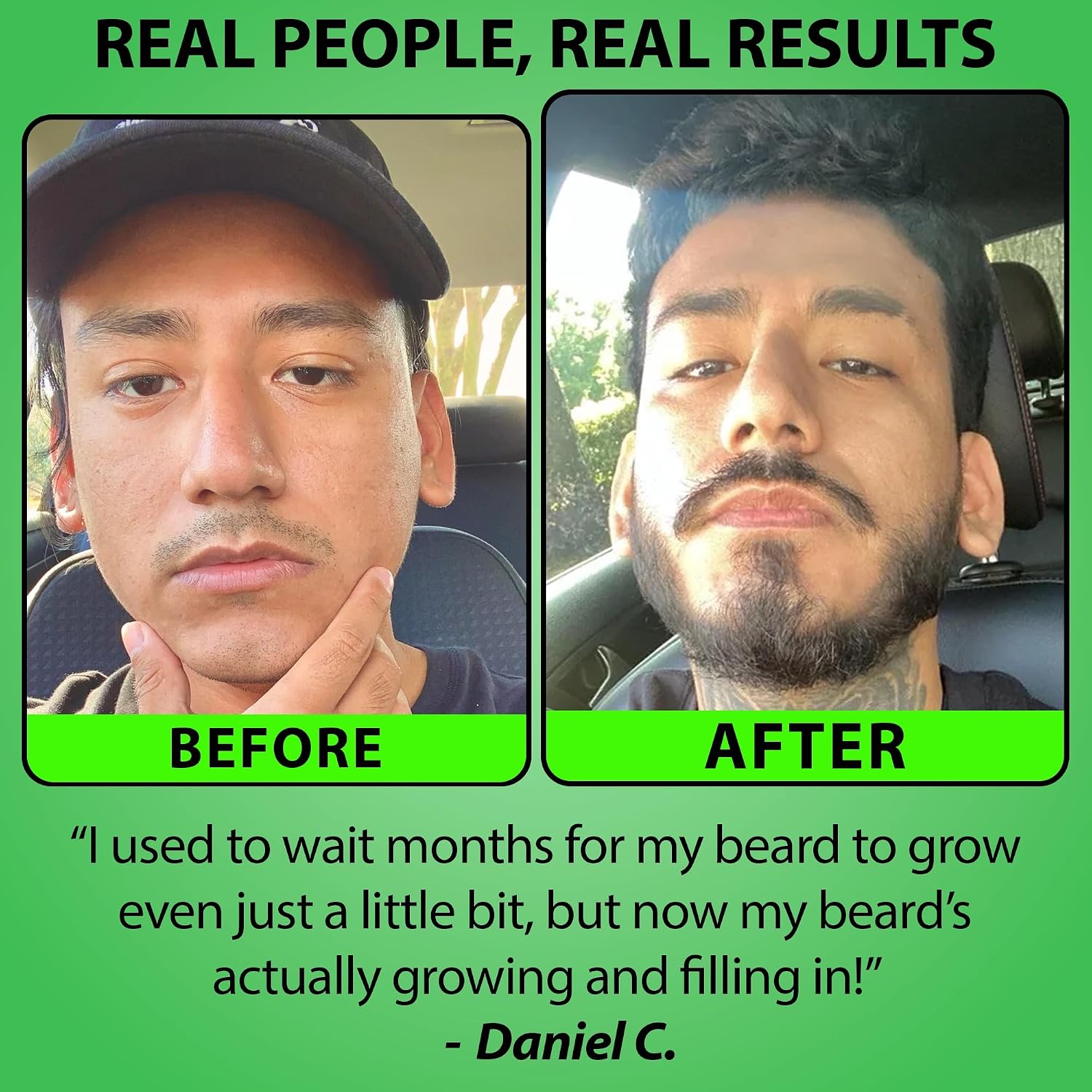BBS BEST BEARD STUFF GROW XXL Beard Oil and 5 Percent Minoxidil Serum Bundle product image 6