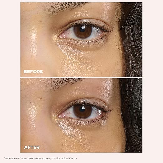 CLARINS Total Eye Lift lifestyle skincare routine image for eye care and smoother-looking eyes