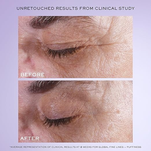Lancôme Rénergie H.C.F. Triple Serum Eye – Lifting & Brightening Eye Serum additional product image 3 for details and texture