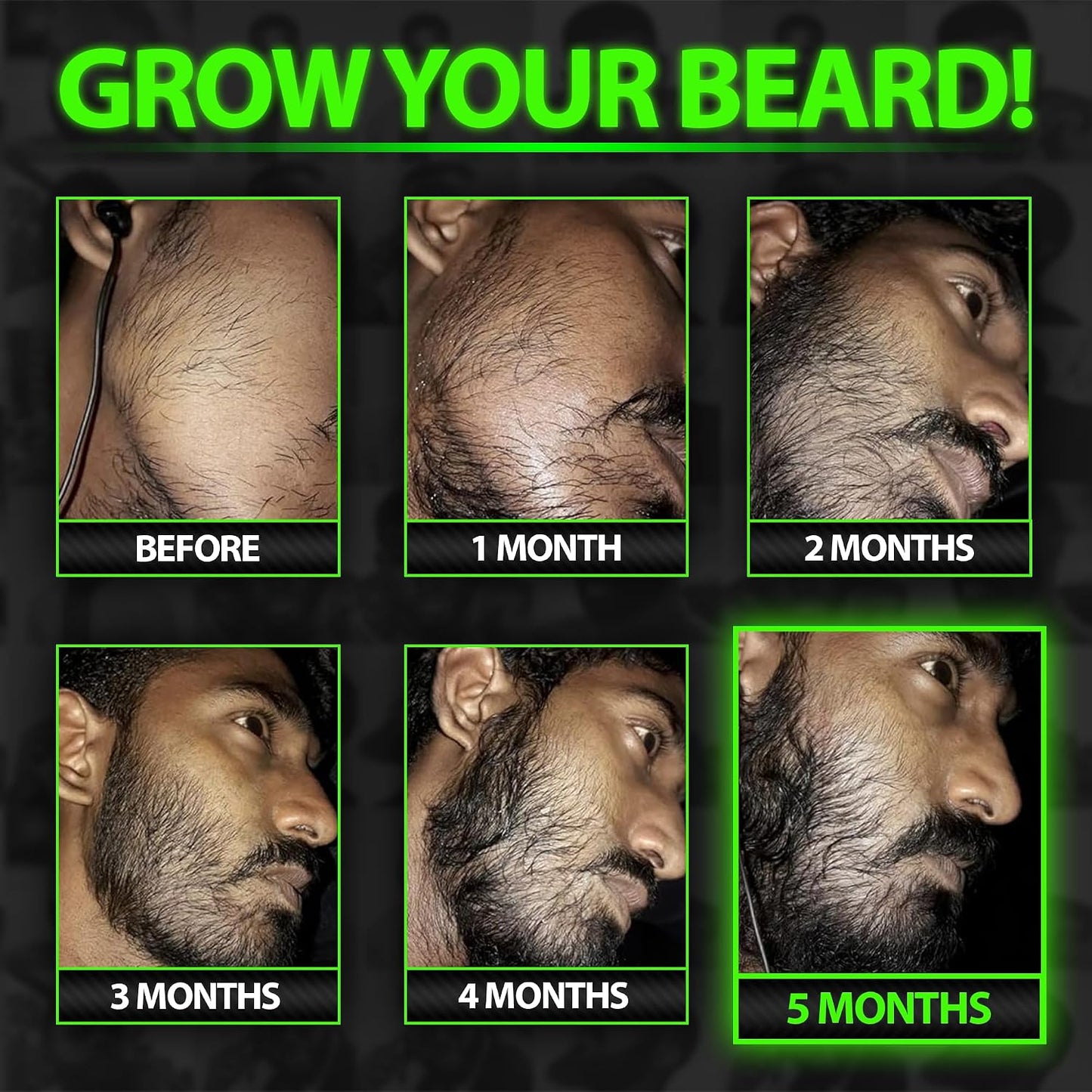 BBS BEST BEARD STUFF GROW XXL Beard Oil and 5 Percent Minoxidil Serum Bundle product image 4
