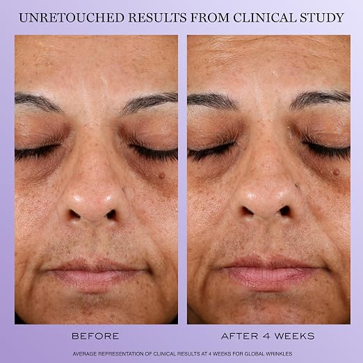 Lancôme Rénergie H.P.N. 300-Peptide Cream – Anti-Aging Moisturizer with Niacinamide additional product image 3 for details and texture