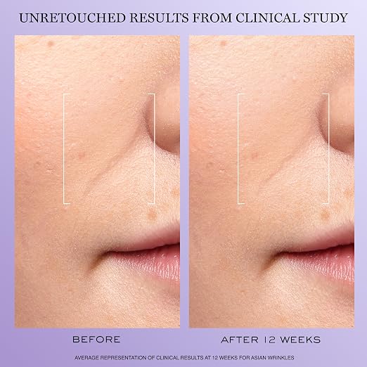 Lancôme Rénergie H.C.F. Triple Serum – Hyaluronic Acid, Vitamin C & Niacinamide additional product image 3 for details and texture