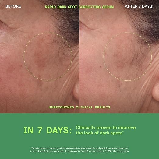 Murad Core Essentials 5-Piece Trial Kit - routine usage image for Murad face cleanser