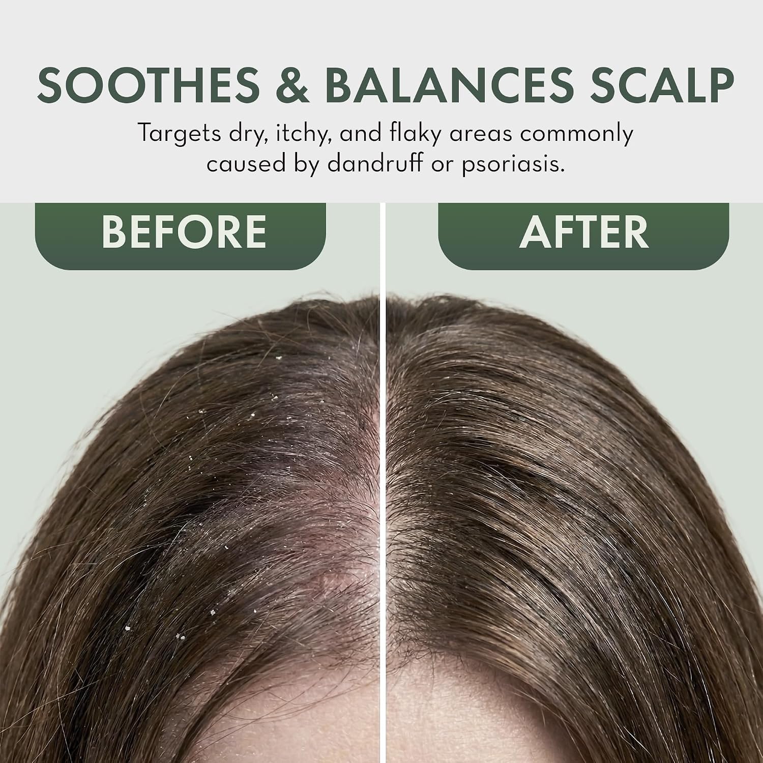 PHARM TO TABLE Tea Tree Scalp Relief Leave In Conditioner 8 oz product image 5