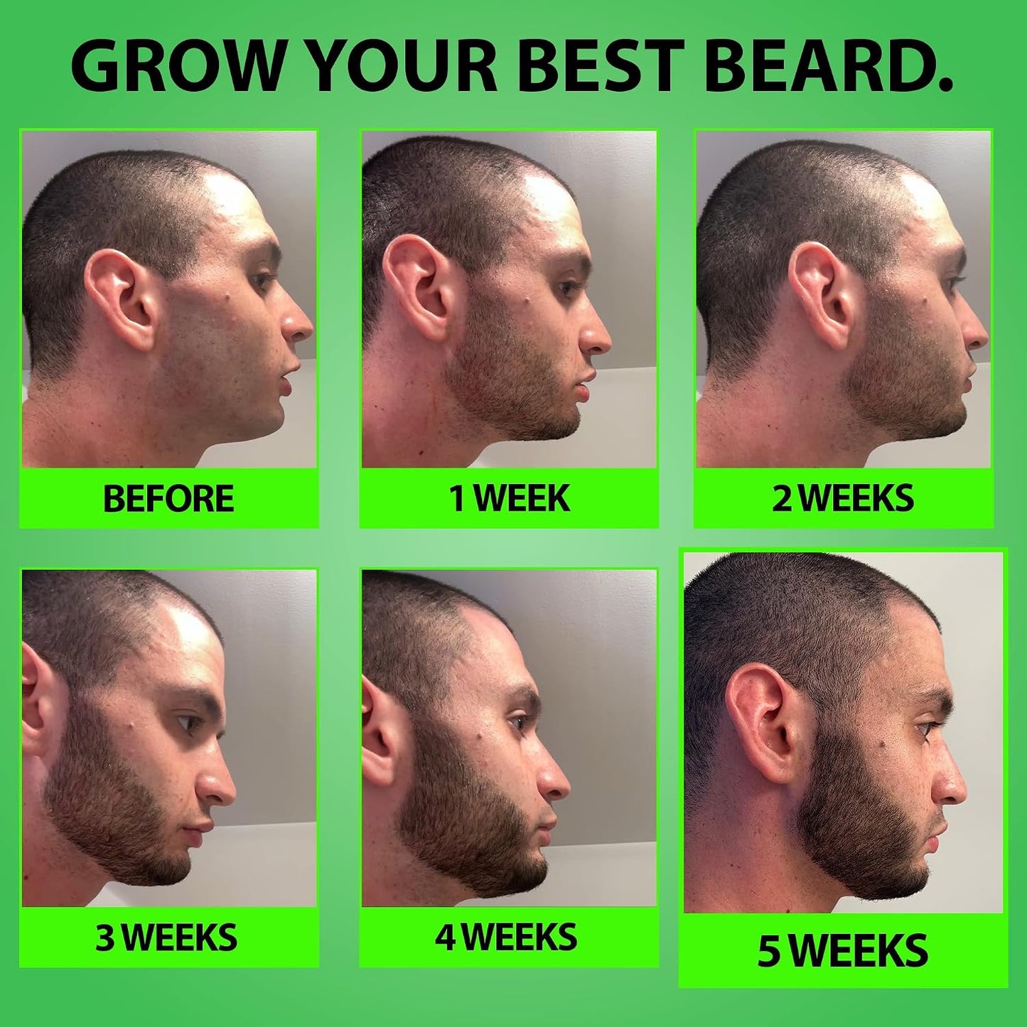BBS BEST BEARD STUFF GROW XXL Beard Oil and 5 Percent Minoxidil Serum Bundle product image 7
