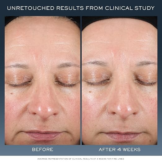 Lancôme Advanced Génifique Night Cream – Barrier Repair Moisturizer with Hyaluronic Acid additional product image 2 for details and texture