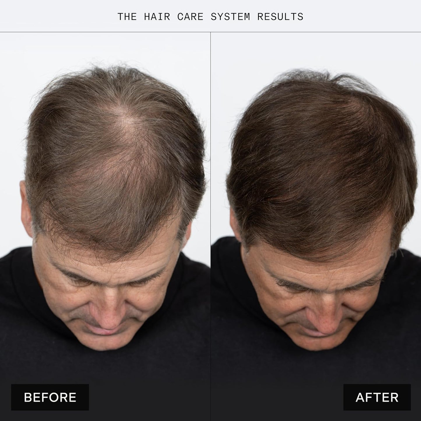 Caldera + Lab luxury men’s hair care system showcasing thicker fuller-looking hair results and premium hair strengthening products for modern grooming routines.