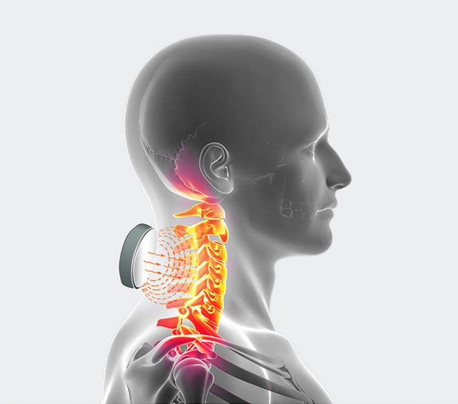 Cervical spine heat therapy diagram showing neck pain relief, muscle relaxation and deep tissue stimulation for tension and posture correction