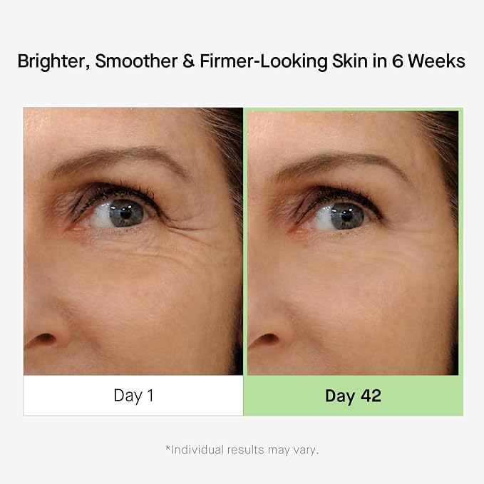 Brand-provided eye-area comparison showing the appearance of fine lines during HEALTHYDERM serum use