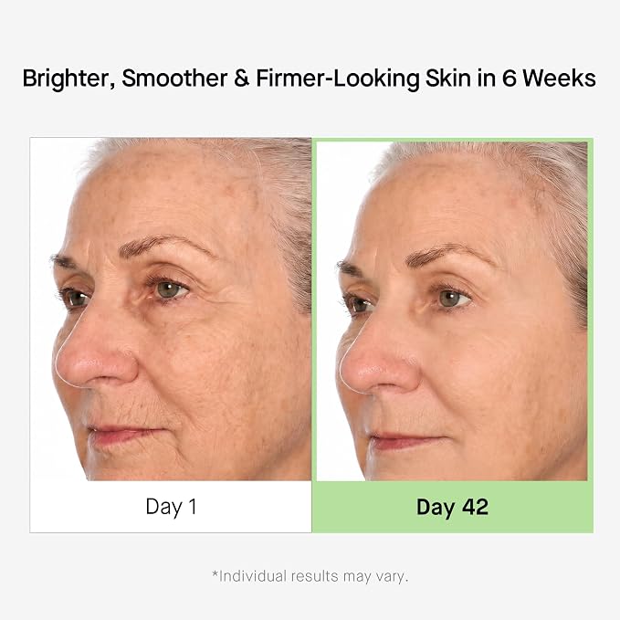 Brand-provided before-and-after images for HEALTHYDERM peptide serum used on mature-looking skin