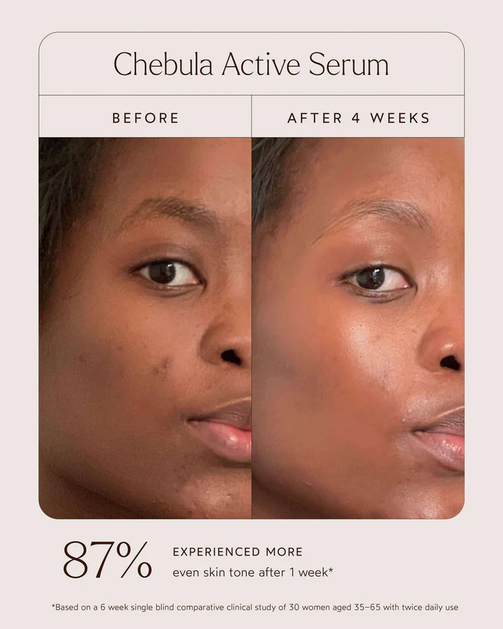 True Botanicals Chebula Active Serum before and after skincare results showing smoother softer and more radiant looking skin