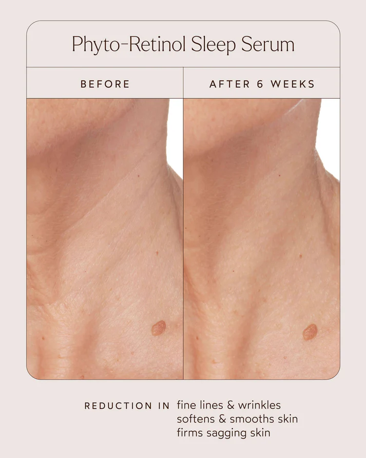 True Botanicals Phyto Retinol Sleep Serum before and after skincare results showing smoother firmer looking skin after 6 weeks